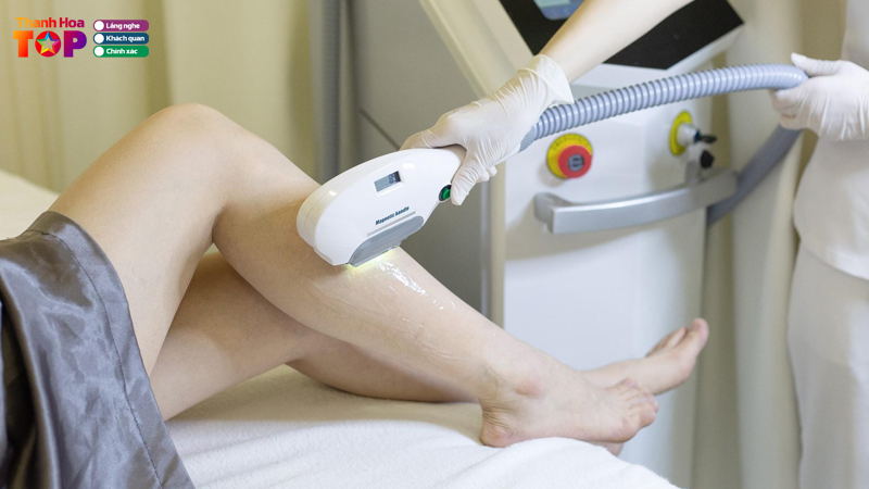 Top-5-spa-triet-long-tai-thanh-hoa-chat-luong-nhat