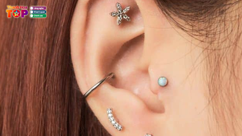 Top-6-dia-chi-xo-khuyen-o-thanh-hoa-nhanh-chong-khong-dau