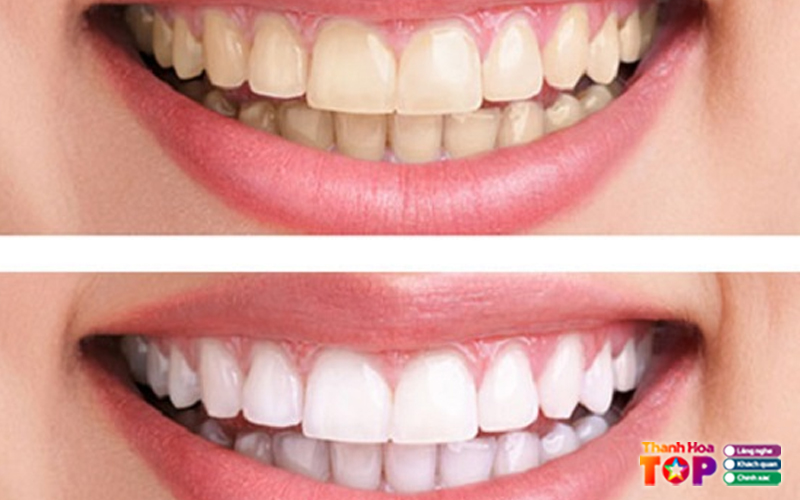 Nha-khoa-hai-phuc-dental-thanhhoatoplist