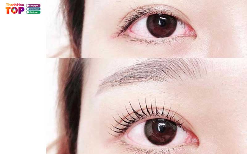 Uon-mi-collagen-thanhhoatoplist