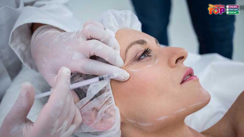 Xoa-nep-nhan-o-thanh-hoa